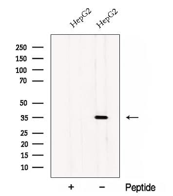 Polyclonal Rabbit anti-Human CWC15 Antibody (WB)