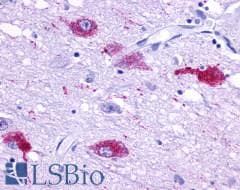PathPlus™ Polyclonal Rabbit anti-Human QRFPR / GPR103 Antibody (Cytoplasmic Domain, IHC)