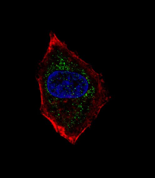 Polyclonal Rabbit anti-Human NEUROD1 Antibody (aa15-45, IHC, IF, WB)