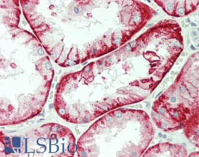 IHC-plus™ SLC7A8 / LAT2 Antibody (clone 7C2)