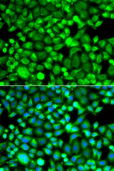 IHC-plus™ Polyclonal Rabbit anti-Human PSMB8 / LMP7 Antibody (IHC, IF, WB)