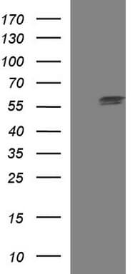TUBA1A / Tubulin Alpha 1a Antibody (clone OTI2C8)