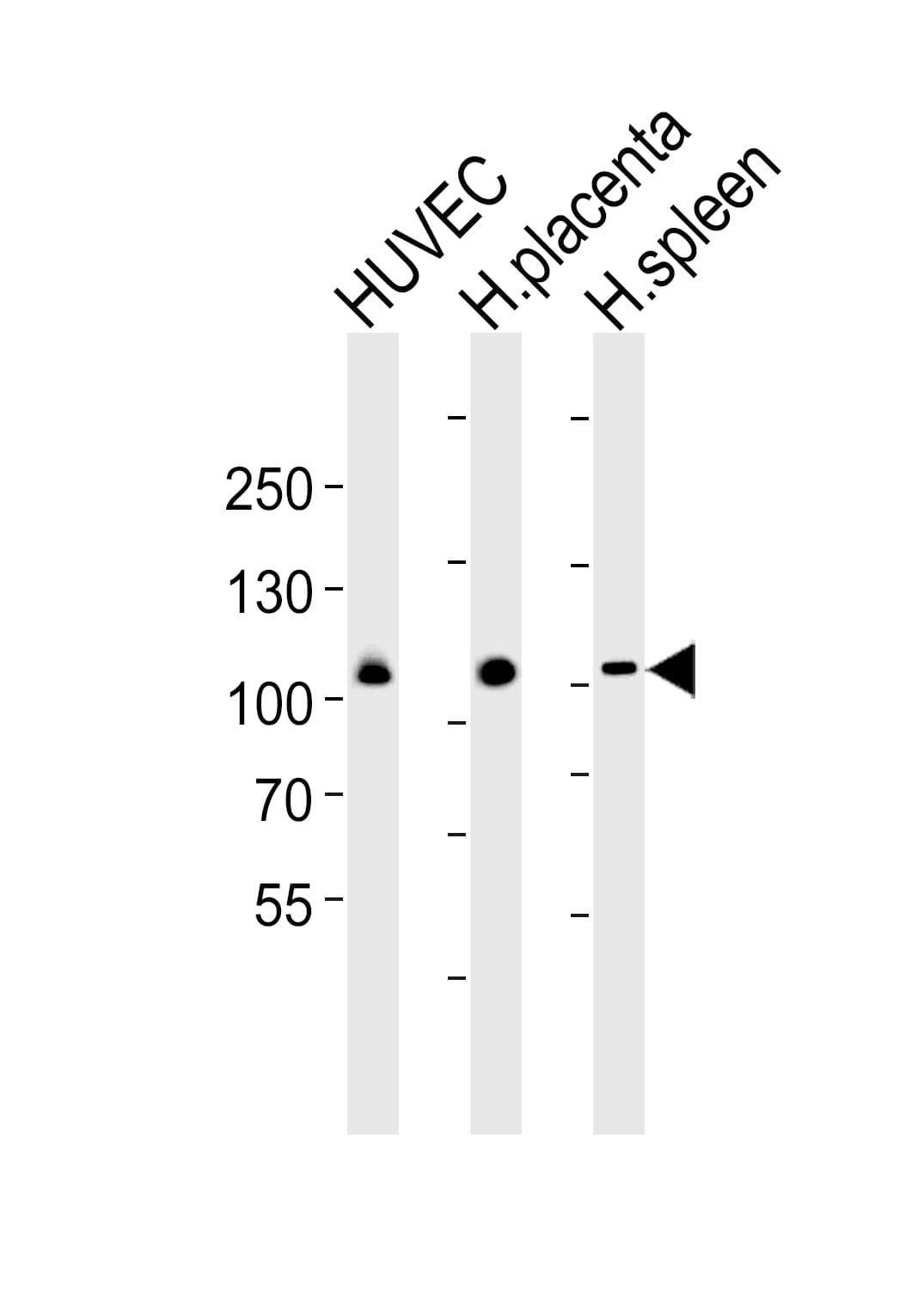GP1BA / CD42b Antibody (aa344-378)