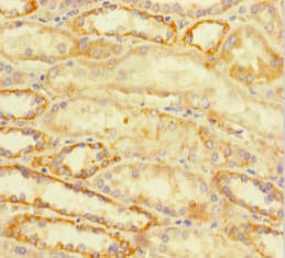 Polyclonal Rabbit anti-Human ATRX Antibody (IHC, IF)