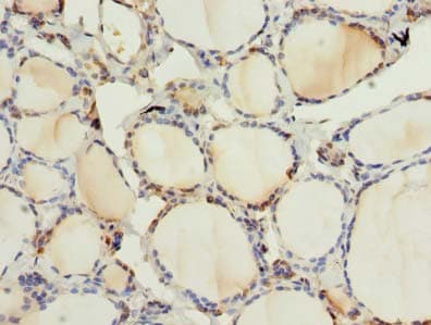 ARMCX6 Antibody