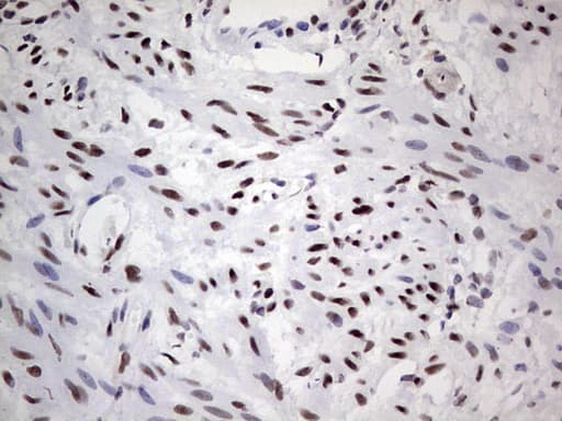 SAE1 Antibody (clone OTI3C3)