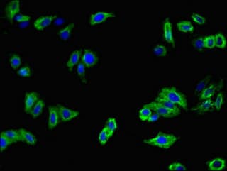 Polyclonal Rabbit anti-Human MFI2 / p97 Antibody