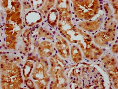 Polyclonal Rabbit anti-Human GSX2 / GSH2 Antibody (IHC)