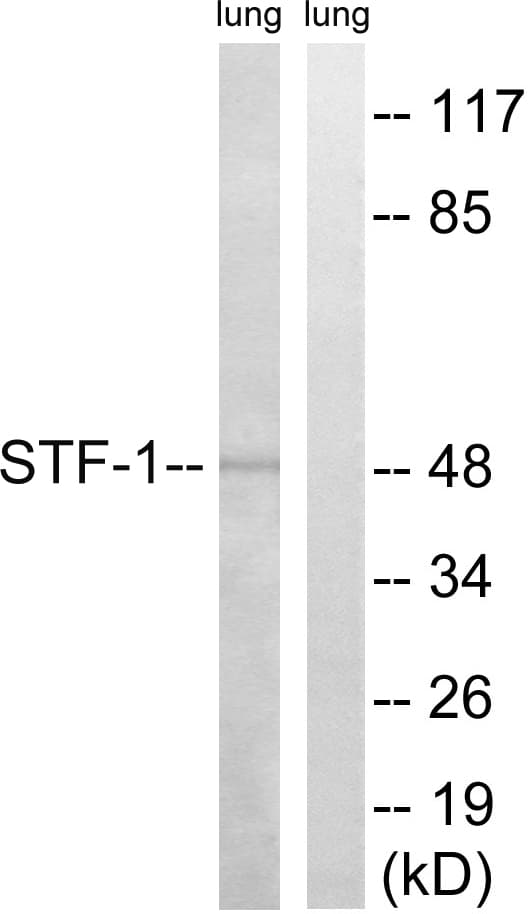 NR5A1 / SF1 Antibody (aa169-218)