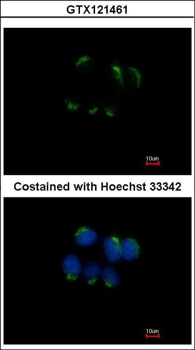 TFF1 / pS2 Antibody