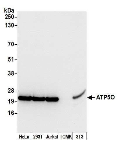 ATP5O Antibody (aa163-213)