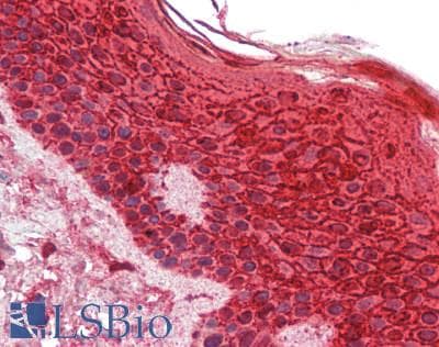 IHC-plus™ CALML5 Antibody (aa2-146)