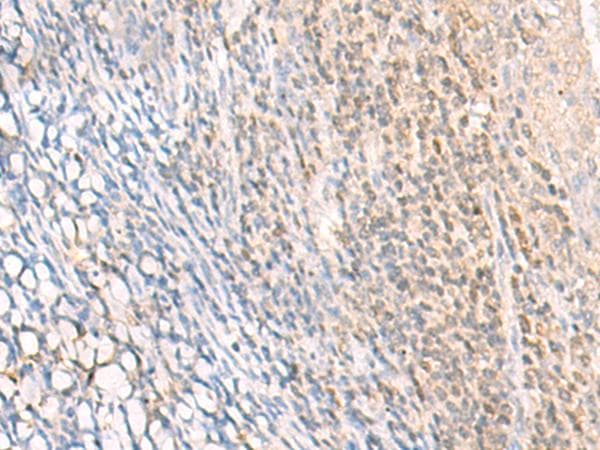 EPSTI1 Antibody