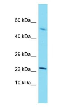 Polyclonal Rabbit anti-Human SCP2 / SCPX Antibody (N-Terminus, WB)