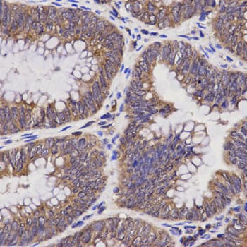 IHC-plus™ Polyclonal Rabbit anti-Human TAP2 Antibody (IHC, IF, WB)