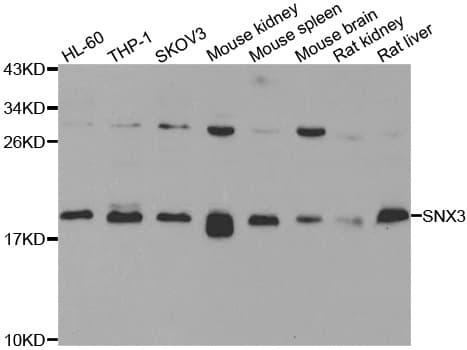 Polyclonal Rabbit anti-Human SNX3 Antibody (IHC, IF, WB)