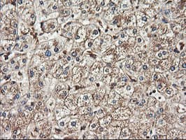 TUBAL3 Antibody (clone OTI4D8)