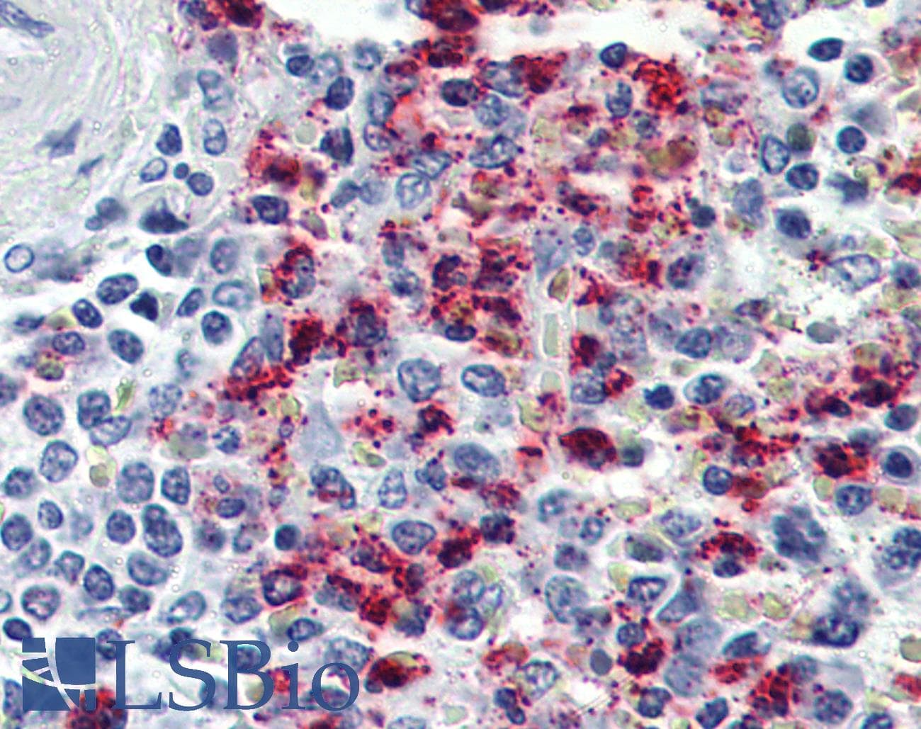 IHC-plus™ CYSLT2 / CYSLTR2 Antibody (N-Terminus)