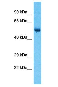RBPJL Antibody (aa2-51)