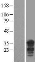PPHLN1 Protein (Over-Expression Lysate Myc-DDK (Flag))