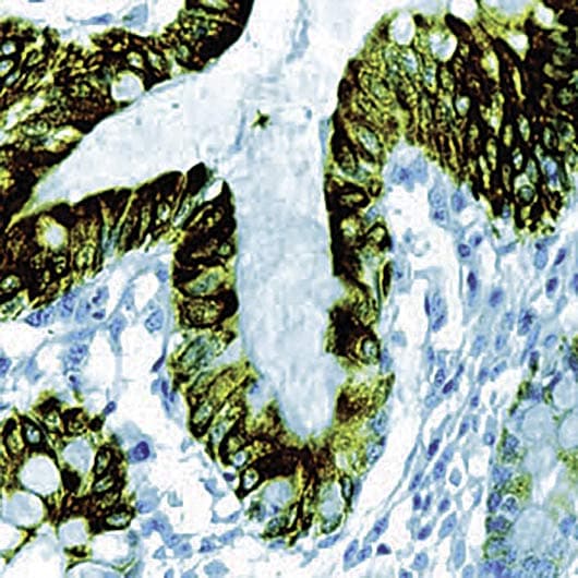 KRT8 / CK8 / Cytokeratin 8 Antibody (clone 35bH11)