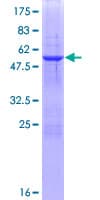 Human RBCK1 Protein (Recombinant GST)