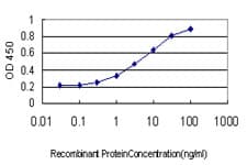 PathPlus™ FOXA2 Antibody (clone 2F12)