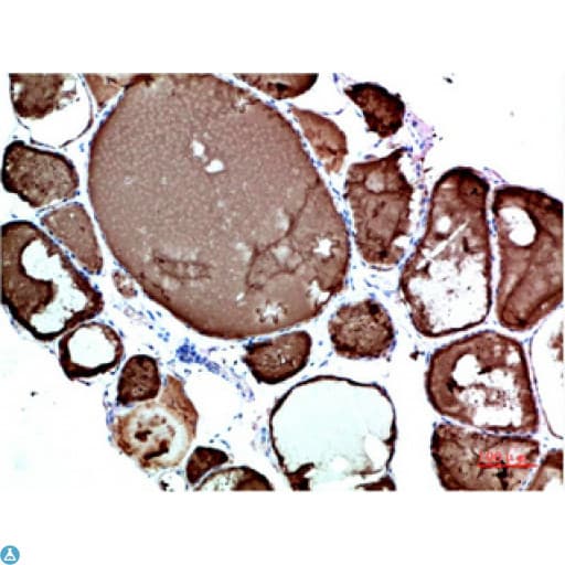TTR / Transthyretin Antibody