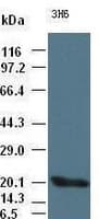 Monoclonal Mouse anti-Human IL6 / Interleukin 6 Antibody (clone OTI3H6, IF, WB)