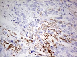 Monoclonal Mouse anti-Human CD68 Antibody (clone OTI8A4, aa22-319, IHC, WB)