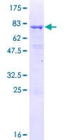 Human TCP10 Protein (Recombinant GST)