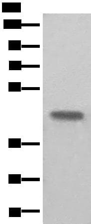 Polyclonal Rabbit anti-Human BHMT2 Antibody (IHC, WB)