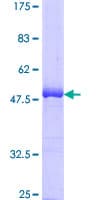 Human BAK1 / BAK Protein (Recombinant GST)