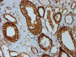 CTNNB1 / Beta Catenin Antibody (clone OTI3F9)