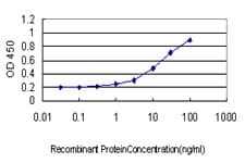IHC-plus™ ART3 Antibody (clone 3A2)