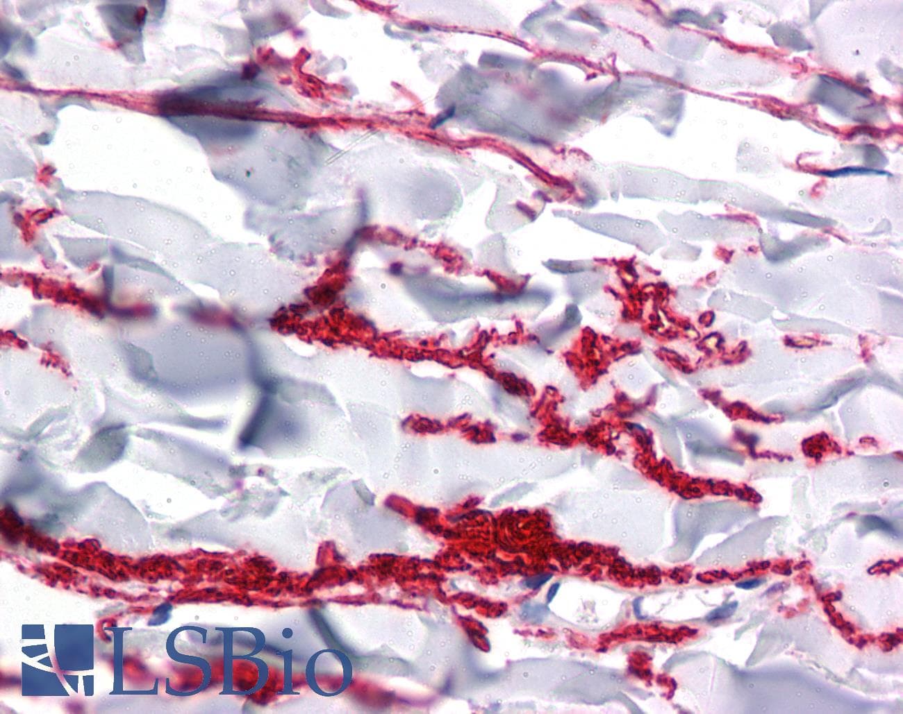 IHC-plus™ GAREM / FAM59A Antibody