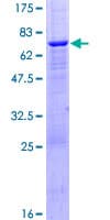 Human PPM1K Protein (Recombinant GST)