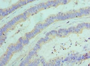 Polyclonal Rabbit anti-Human GOLM1 / GP73 / GOLPH2 Antibody (aa112-401, IHC)
