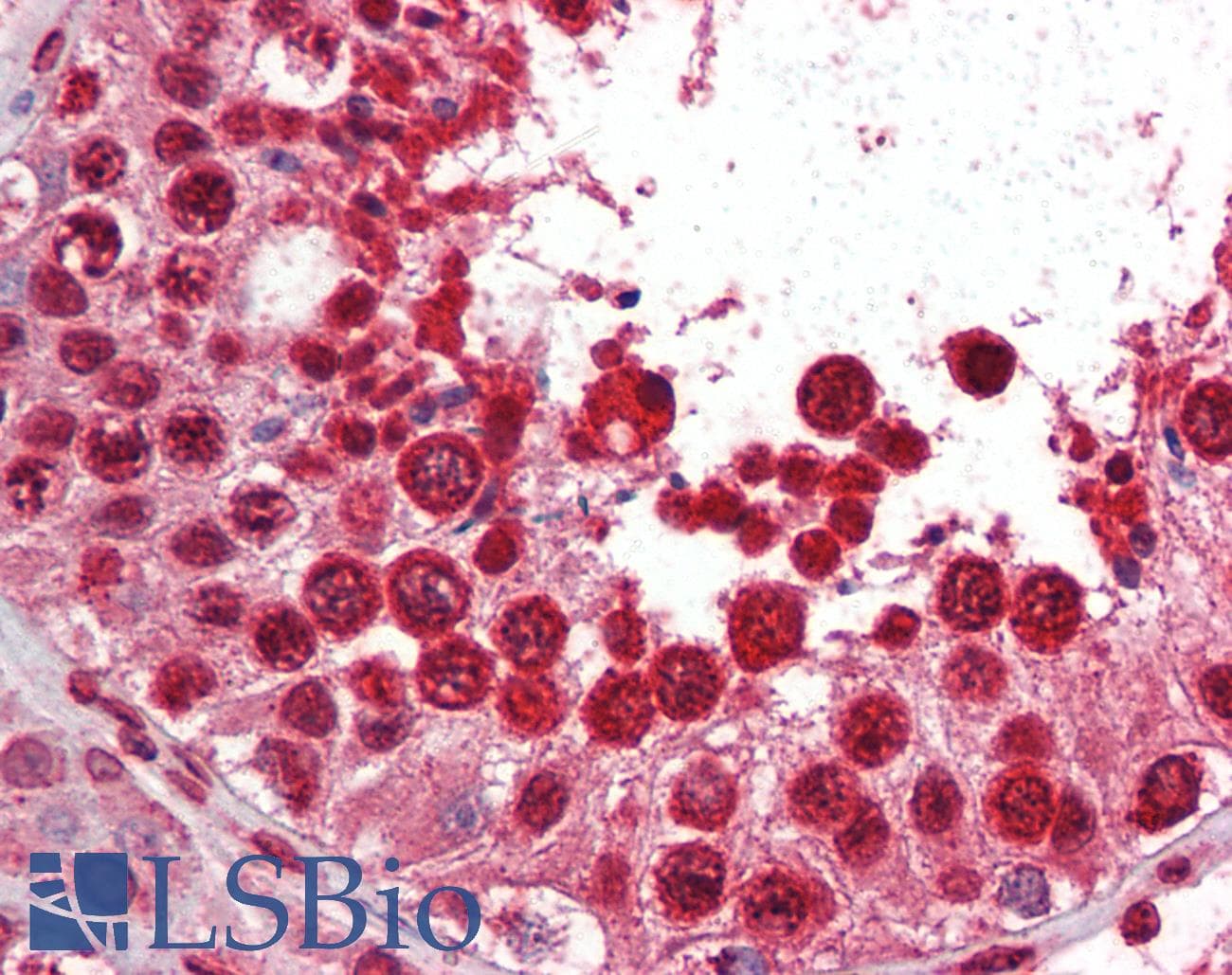 IHC-plus™ HSF1 Antibody (clone 10H8)