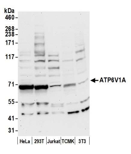 ATP6V1A1 / ATP6V1A Antibody (aa567-617)