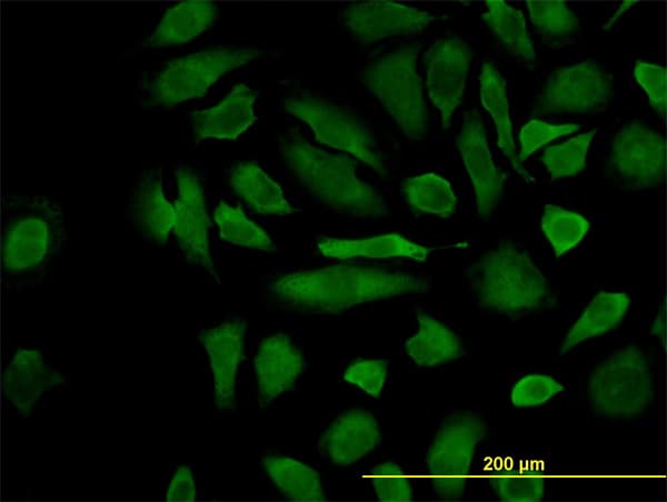 IHC-plus™ CFLAR / FLIP Antibody (clone 2F12)