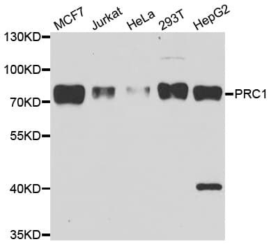 Polyclonal Rabbit anti-Human PRC1 Antibody (IHC, WB)
