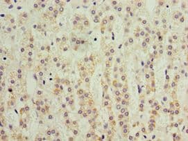 Polyclonal Rabbit anti-Human KLF3 Antibody (aa1-240, IHC)