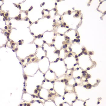 VRK1 Antibody