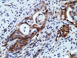 KHK / Ketohexokinase Antibody (clone OTI3D1)