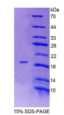 Rat ERP29 Protein (Recombinant His-T7)