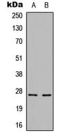 CBLN3 / Cerebellin 3 Antibody (C-Terminus)