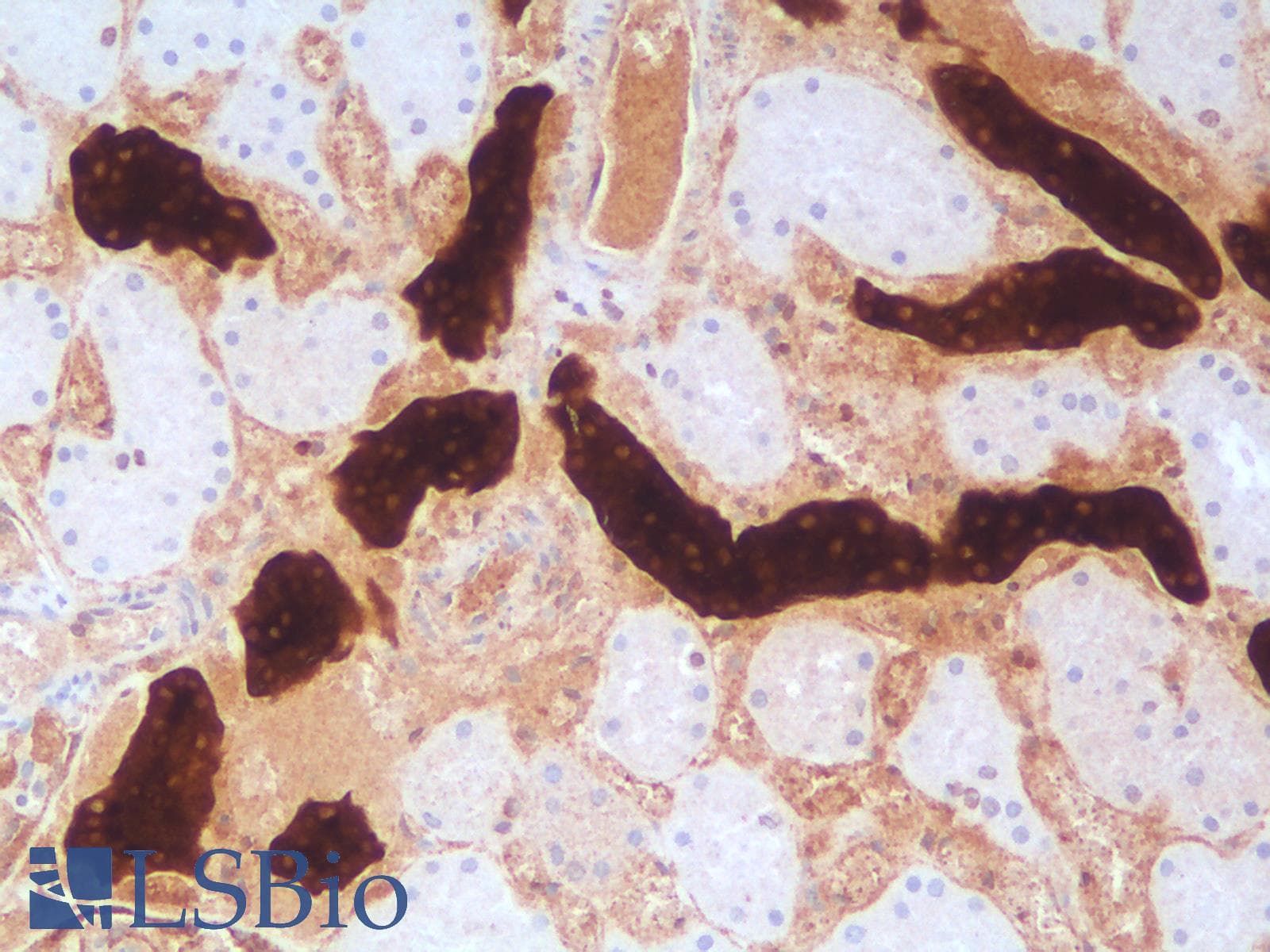 PathPlus™ EMA / MUC1 Antibody (clone rMUC1/960)