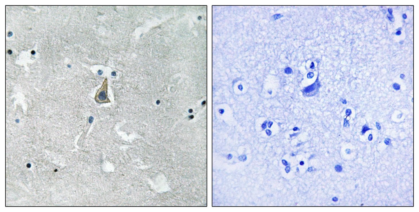 BAX Antibody (phospho-Ser184)