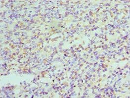 HNRNPD / AUF1 Antibody (aa1-306)